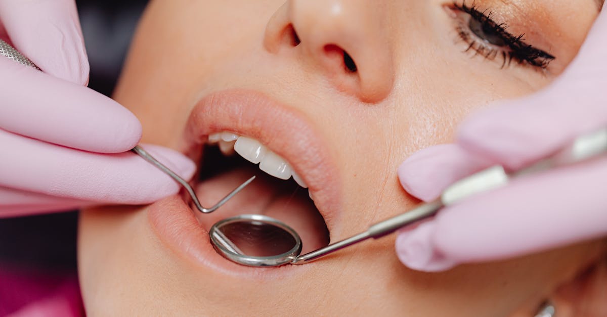 close up photo of a woman getting a dental check up